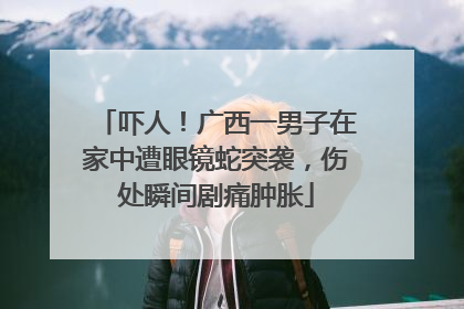 吓人！广西一男子在家中遭眼镜蛇突袭，伤处瞬间剧痛肿胀